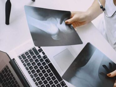 X-Ray