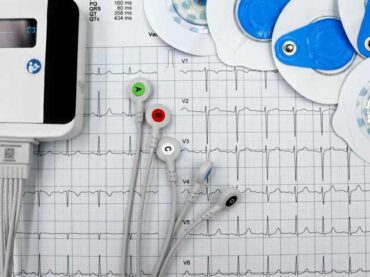 EKG Service