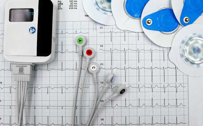 EKG-Service