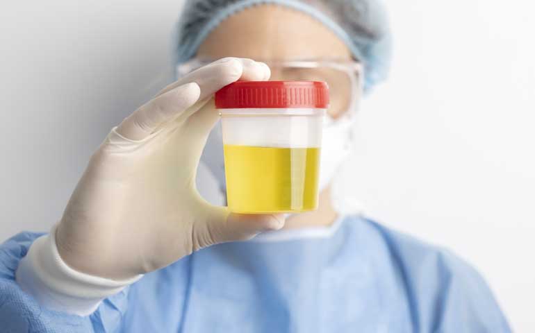 Urine Drug Screening