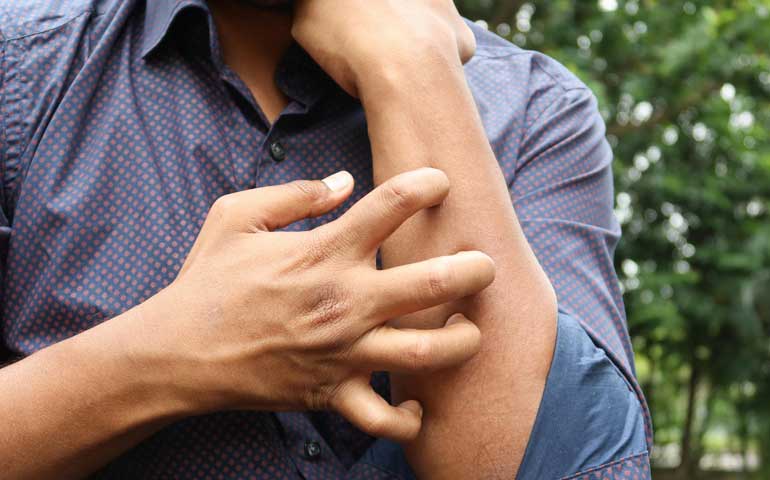 Autoimmune & Allergy Testing