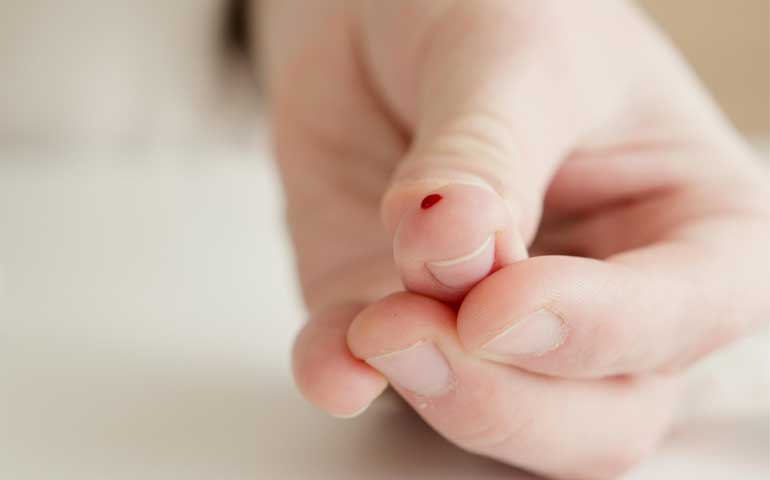 Finger Stick Blood Glucose