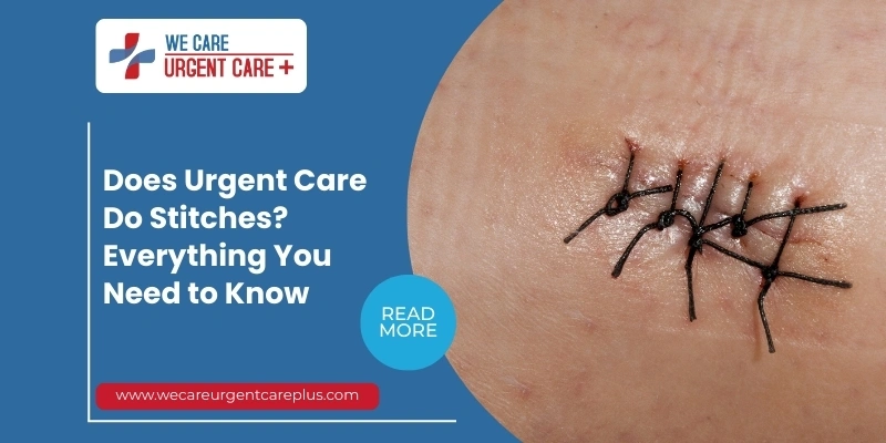 Urgent Care Do Stitches