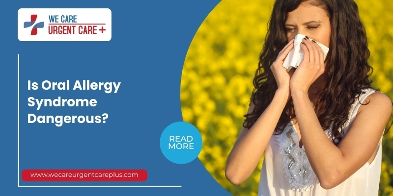 Oral Allergy Syndrome